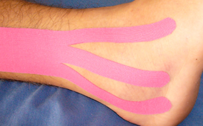 Kinesiotape